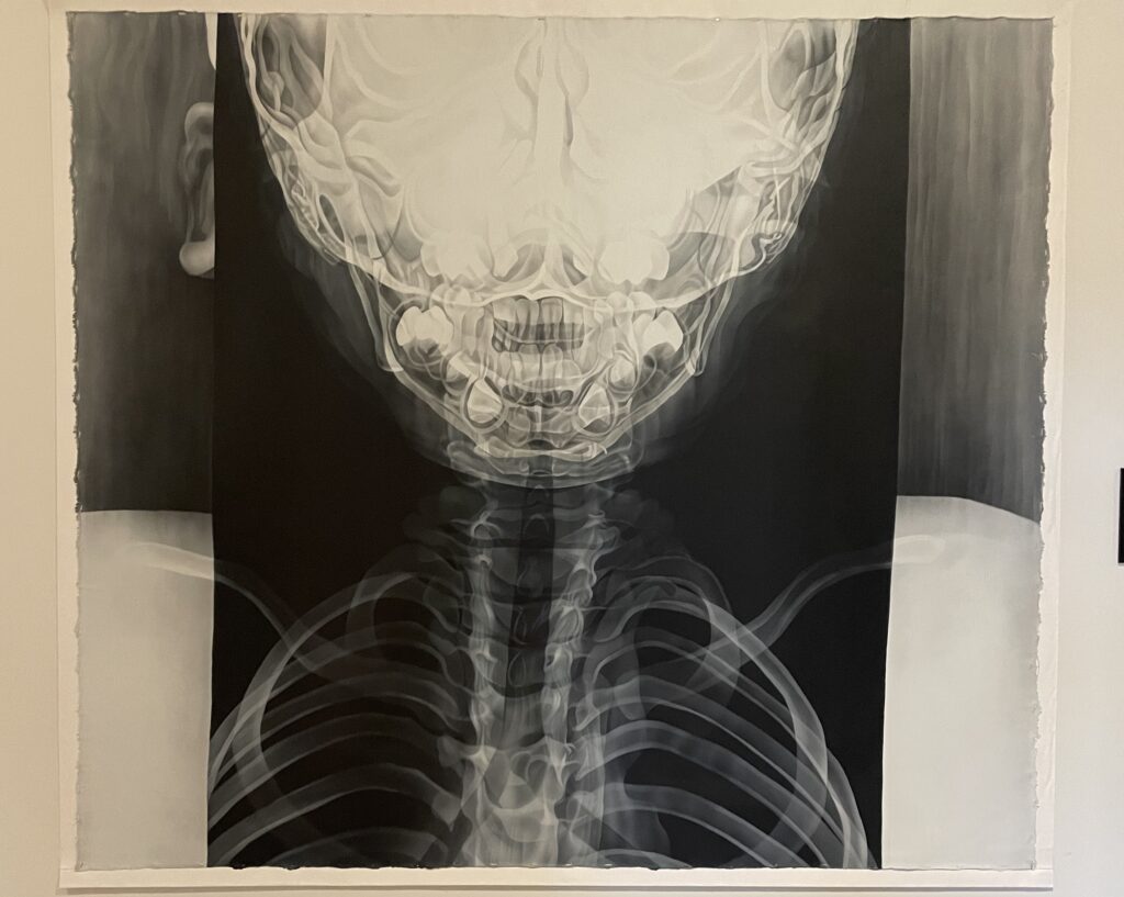 An X-ray painting of a human face, neck and upper ribcage, by artist Jo Hockenhull. (Jonah Barnett/The VanCougar)