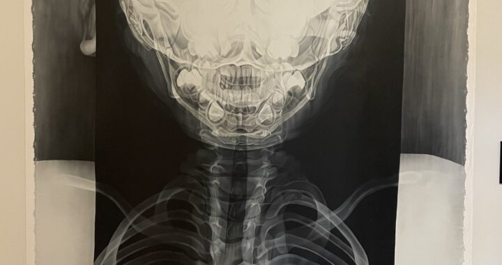 Capturing our insides with x-rays and paint