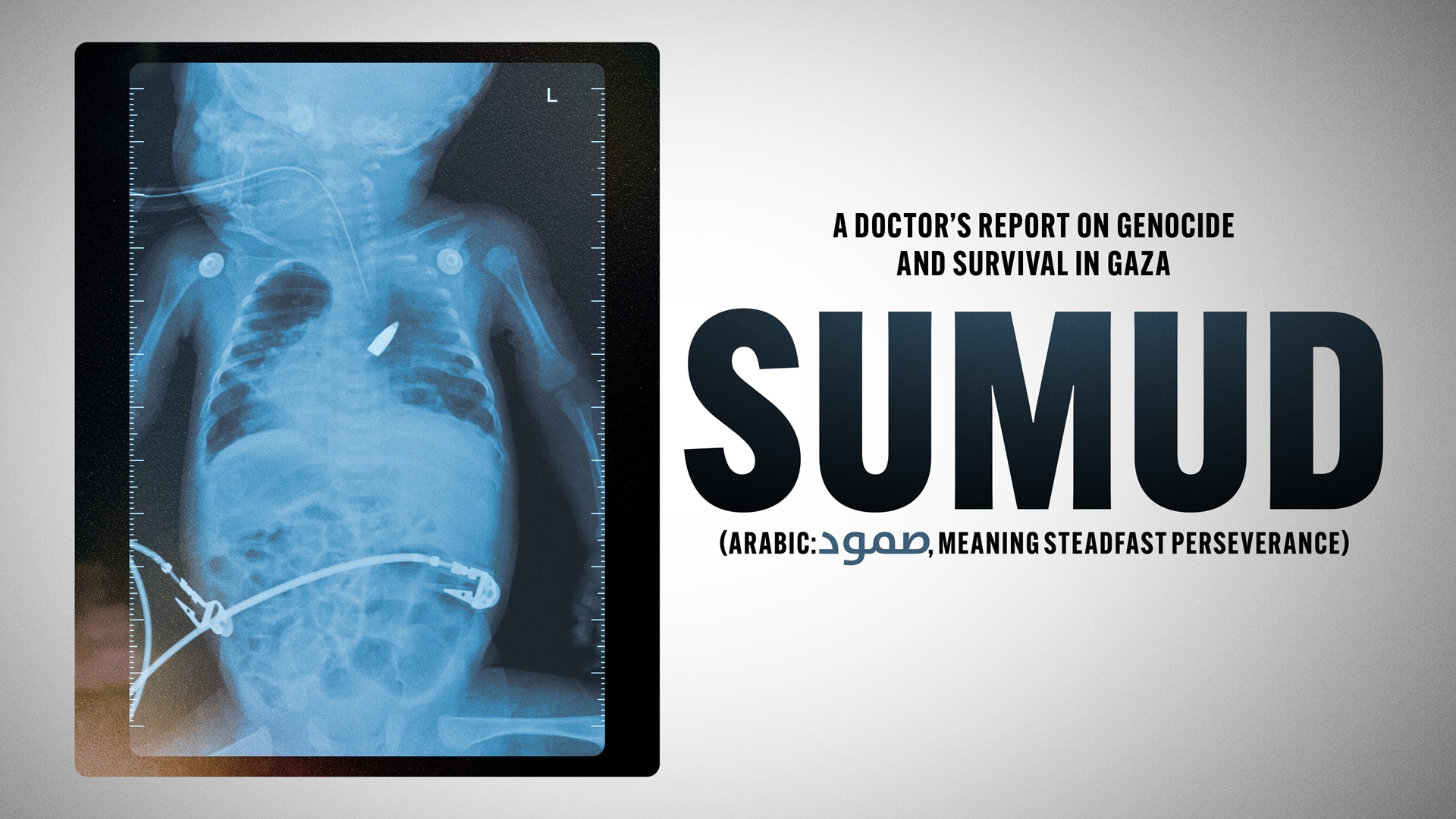 Survival in Gaza: WSUV DocArts Series Screens Film on Medical Workers in Gaza